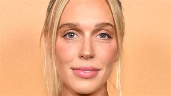 Alex Cooper Admits to Getting Botox Reveals Why She Could Never Get Implants